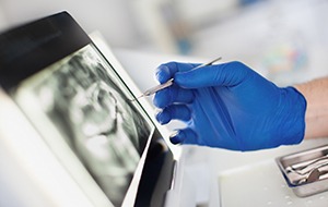 Implant dentist in Canonsburg examining digital X-ray ahead of surgery