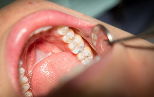 Closeup of healthy smile