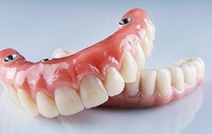 Implant dentures may cost more up front but are often a better investment
