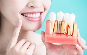 Close up of woman pointing to her smile while holding model of dental implants in Canonsburg