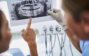 Patient and dentist discussing advanced dental implant procedures while holding X-ray