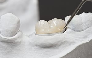Model tooth with restoration