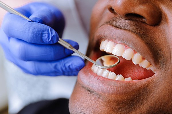 man getting dental checkup