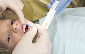 Child receiving fluoride treatment