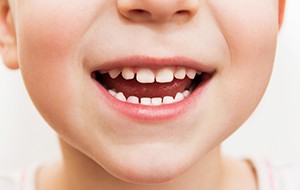 Closeup of child's healthy smile