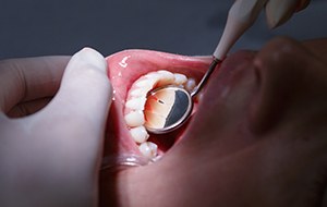 Patient receiving periodontal therapy