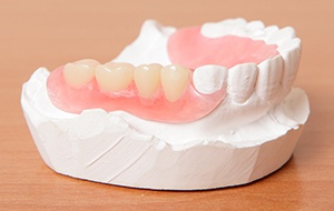 Partial dentures on smile model