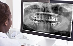 Digital dental x-rays on computer