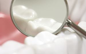 Closeup of teeth during dental treatment