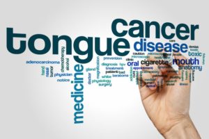 a bunch of words associated with oral cancer