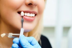 Woman smiling as a dentist matches the color of her teeth