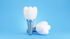 Two model implants- one upright and one laying down- on a light blue background