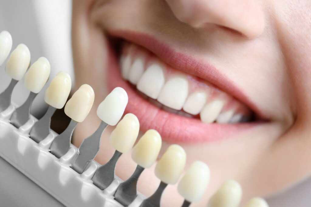 Closeup of woman smiling with shade guide held to teeth