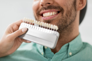 Dentist comparing a set of veneers to a patient’s natural smile