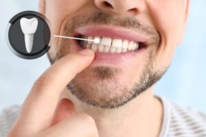 Man smiling while showing his dental implant
