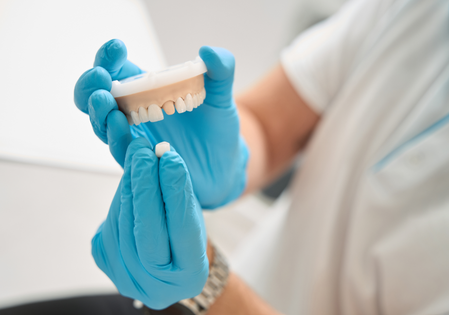Dentist holding model crown
