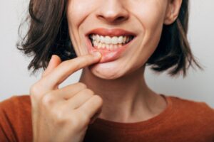 Woman pulling down bottom lip to show gums.